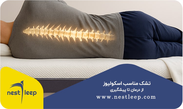 تشک مناسب اسکولیوز: از درمان تا پیشگیری