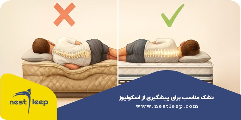 تشک مناسب برای پیشگیری از اسکولیوز​