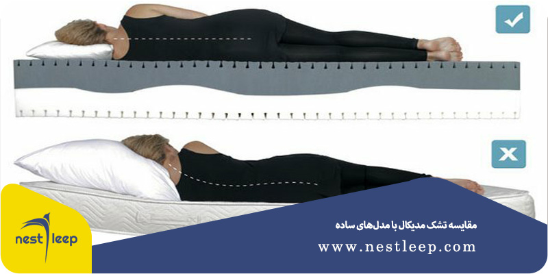 تفاوت پرفروش‌ ترین تشک ایرانی تشک‌ مدیکال با مدل‌ ساده