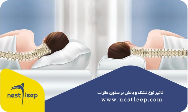 تاثیر نوع تشک و بالش بر ستون فقرات